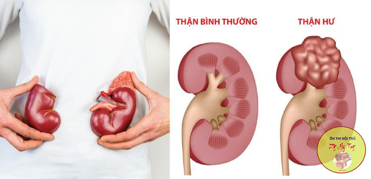 HỘI
