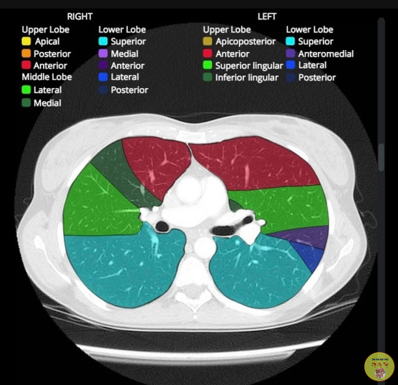 TỰ HỌC ĐỌC CT PHỔI