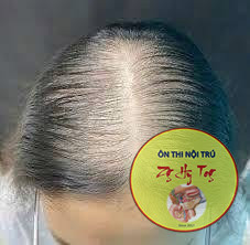 RỤNG
