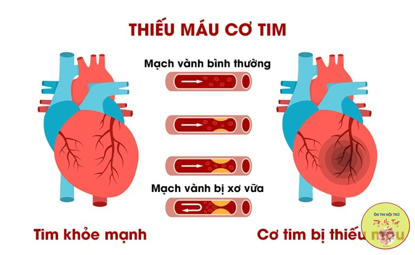 BỆNH