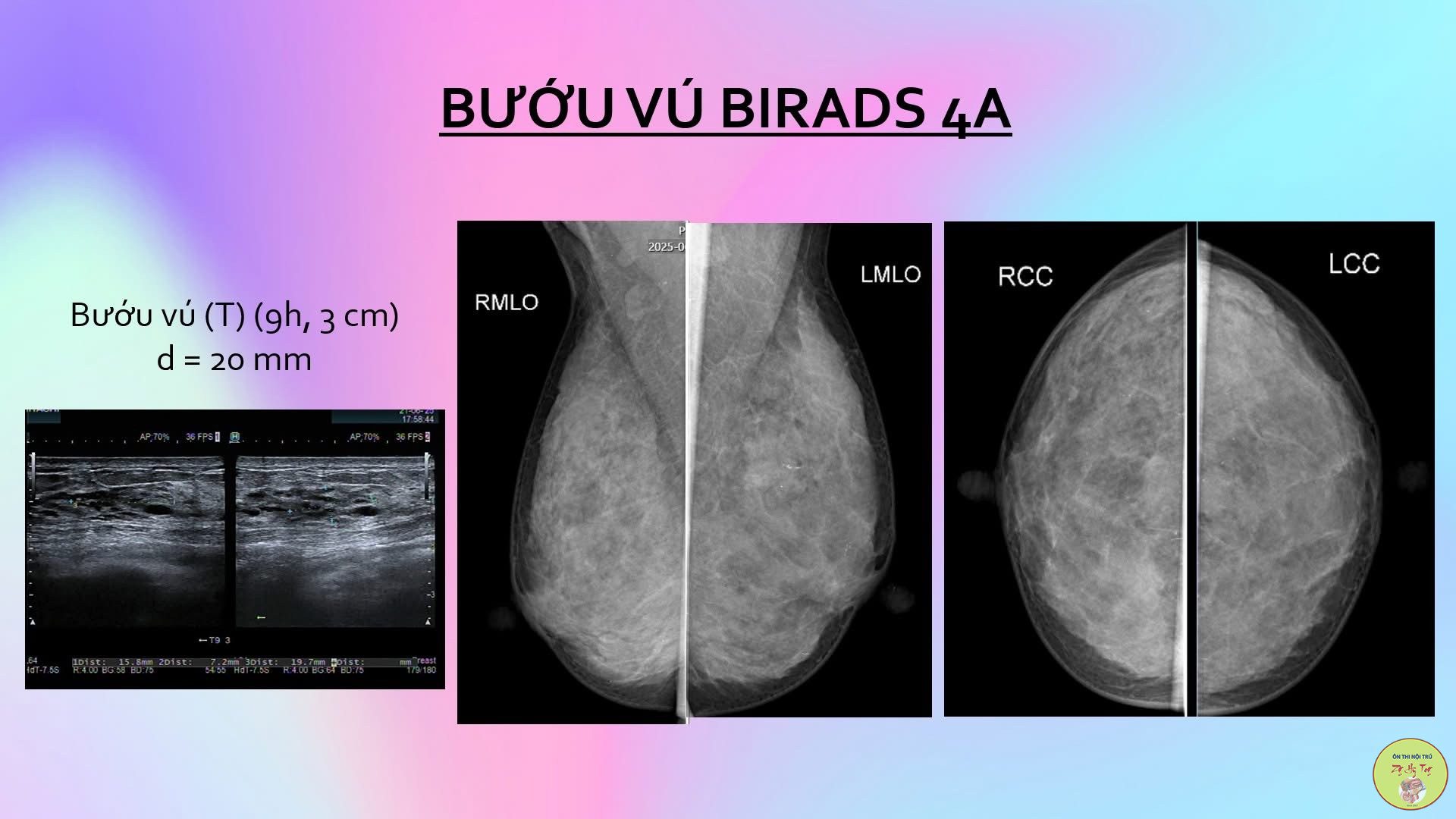 U VÚ NHỮNG ĐIỀU CẦN BIẾT