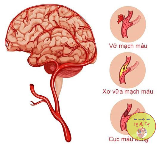 ĐỘT QUỴ KIẾN THỨC CẦN BIẾT