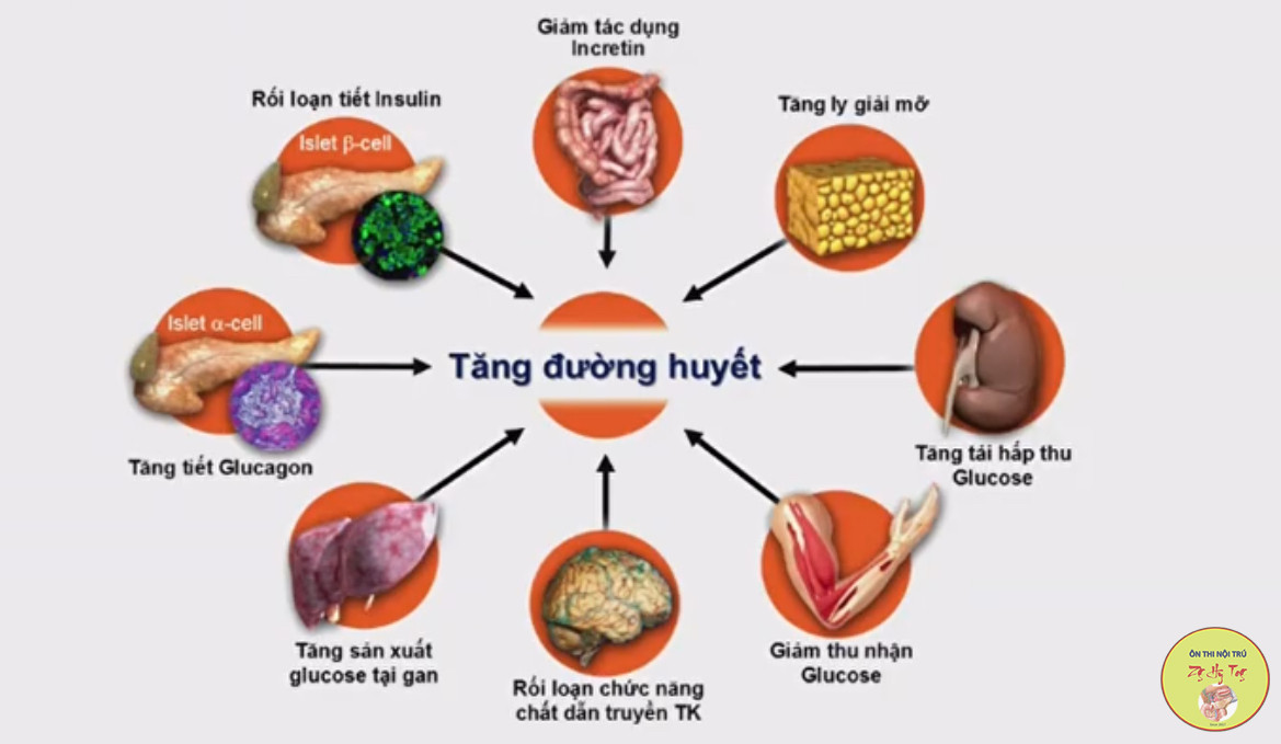 CHIẾN LƯỢC ĐIỀU TRỊ ĐÁI THÁO ĐƯỜNG TYPE II