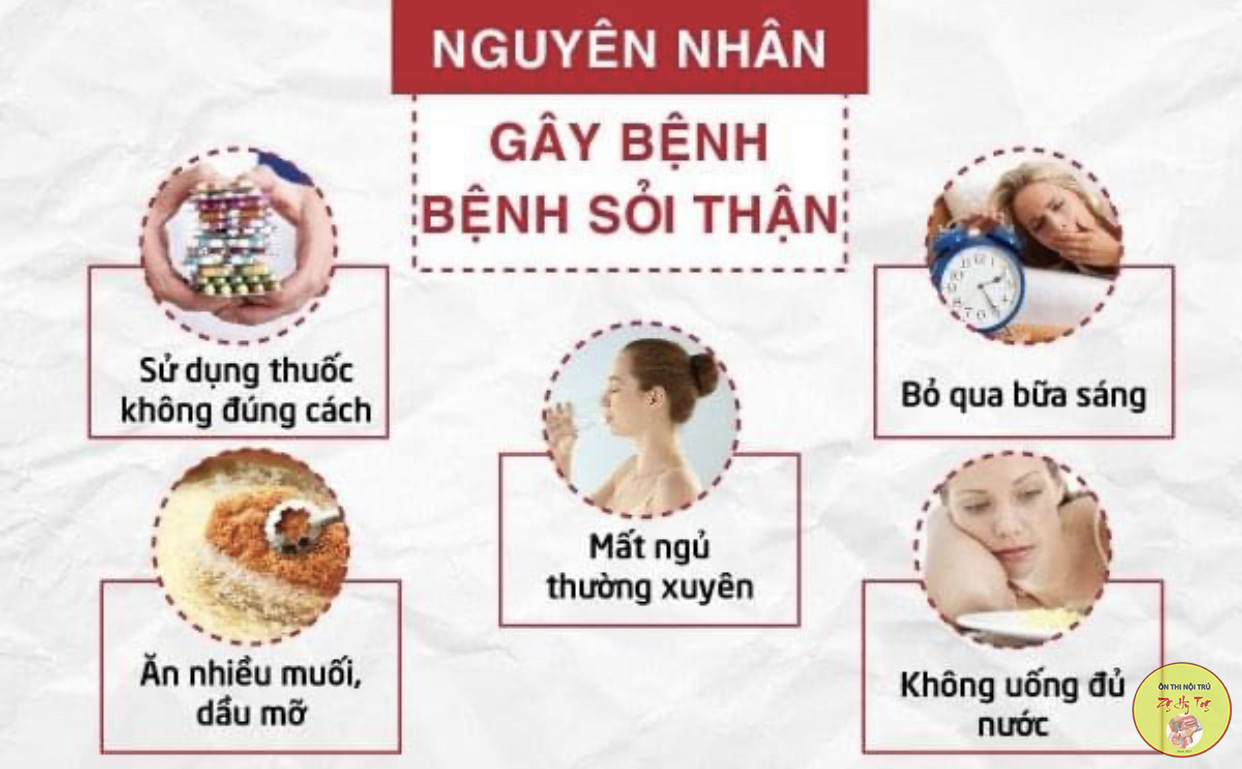 SỎI