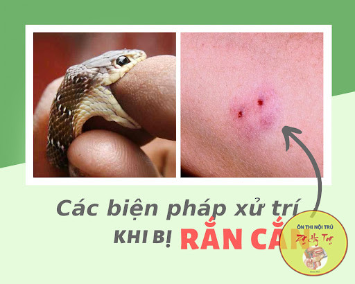 NỘI KHOA - RẮN ĐỘC CẮN [CẤP CỨU CƠ BẢN]